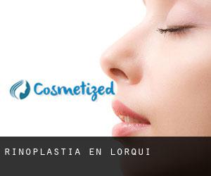 Rinoplastia en Lorquí