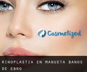 Rinoplastia en Mañueta / Baños de Ebro Rinoplastia en Mañueta / Baños de Ebro