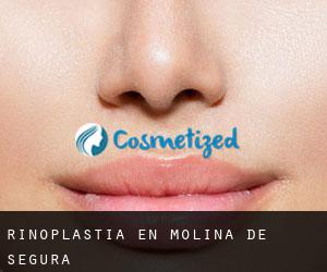 Rinoplastia en Molina de Segura Rinoplastia en Molina de Segura