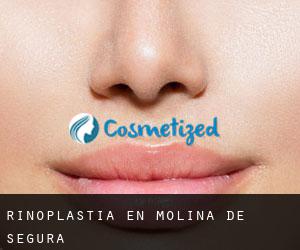 Rinoplastia en Molina de Segura