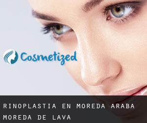 Rinoplastia en Moreda Araba / Moreda de Álava Rinoplastia en Moreda Araba / Moreda de Álava