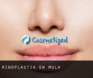 Rinoplastia en Mula