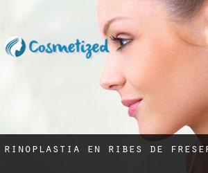 Rinoplastia en Ribes de Freser Rinoplastia en Ribes de Freser