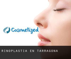 Rinoplastia en Tarragona