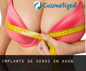Implante de Senos en Agón Implante de Senos en Agón