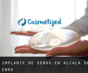 Implante de Senos en Alcalá de Ebro Implante de Senos en Alcalá de Ebro