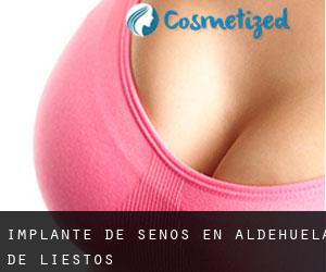 Implante de Senos en Aldehuela de Liestos Implante de Senos en Aldehuela de Liestos