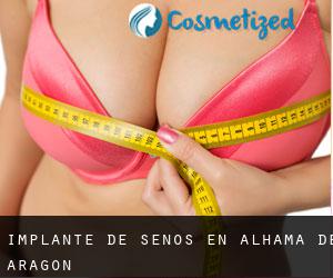 Implante de Senos en Alhama de Aragón Implante de Senos en Alhama de Aragón