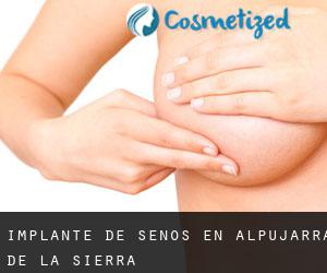 Implante de Senos en Alpujarra de la Sierra Implante de Senos en Alpujarra de la Sierra