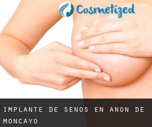 Implante de Senos en Añón de Moncayo Implante de Senos en Añón de Moncayo