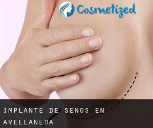 Implante de Senos en Avellaneda Implante de Senos en Avellaneda