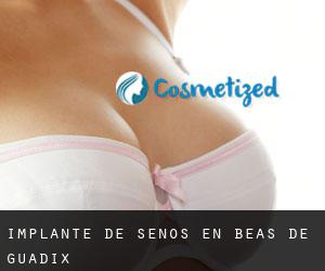 Implante de Senos en Beas de Guadix Implante de Senos en Beas de Guadix