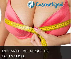 Implante de Senos en Calasparra Implante de Senos en Calasparra
