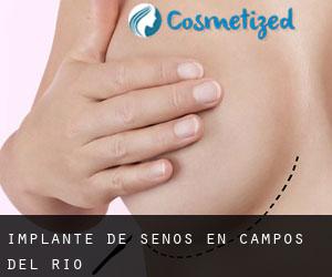 Implante de Senos en Campos del Río Implante de Senos en Campos del Río