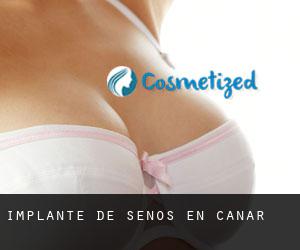 Implante de Senos en Cáñar Implante de Senos en Cáñar