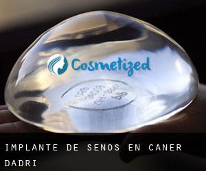 Implante de Senos en Caner d'Adri Implante de Senos en Caner d'Adri