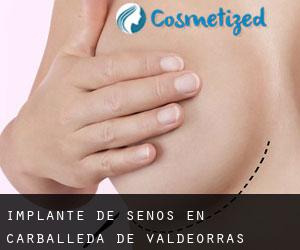 Implante de Senos en Carballeda de Valdeorras Implante de Senos en Carballeda de Valdeorras