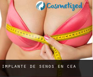 Implante de Senos en Cea Implante de Senos en Cea