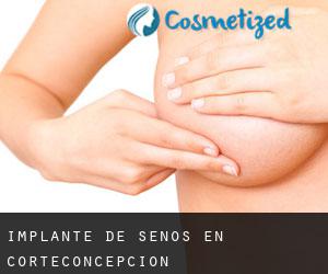 Implante de Senos en Corteconcepción Implante de Senos en Corteconcepción