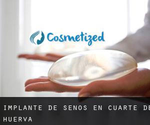 Implante de Senos en Cuarte de Huerva Implante de Senos en Cuarte de Huerva
