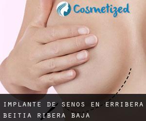 Implante de Senos en Erribera Beitia / Ribera Baja