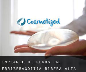 Implante de Senos en Erriberagoitia / Ribera Alta