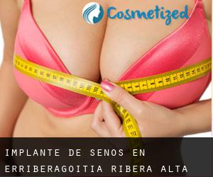 Implante de Senos en Erriberagoitia / Ribera Alta Implante de Senos en Erriberagoitia / Ribera Alta