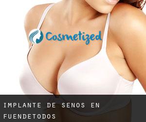 Implante de Senos en Fuendetodos Implante de Senos en Fuendetodos