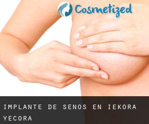 Implante de Senos en Iekora / Yécora Implante de Senos en Iekora / Yécora