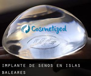 Implante de Senos en Islas Baleares