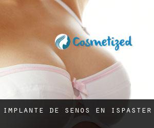 Implante de Senos en Ispaster Implante de Senos en Ispaster