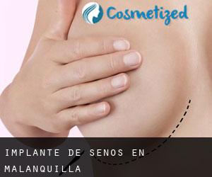Implante de Senos en Malanquilla Implante de Senos en Malanquilla