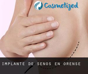 Implante de Senos en Orense Implante de Senos en Orense