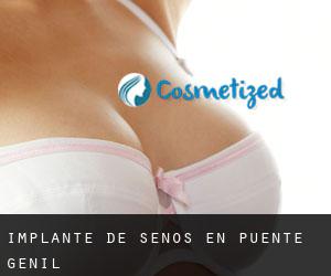 Implante de Senos en Puente-Genil Implante de Senos en Puente-Genil