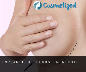 Implante de Senos en Ricote Implante de Senos en Ricote