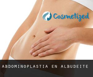 Abdominoplastia en Albudeite