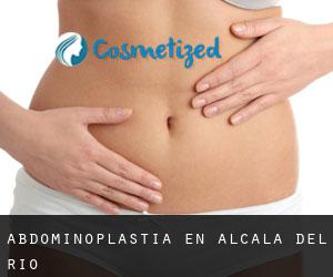 Abdominoplastia en Alcalá del Río
