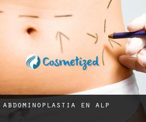 Abdominoplastia en Alp Abdominoplastia en Alp