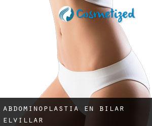 Abdominoplastia en Bilar / Elvillar