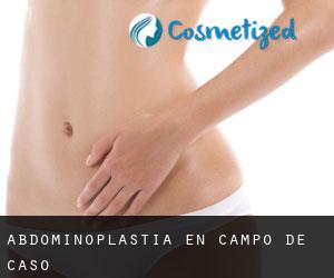 Abdominoplastia en Campo de Caso