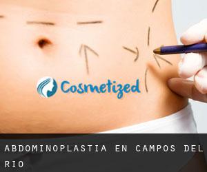 Abdominoplastia en Campos del Río