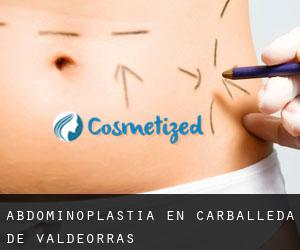 Abdominoplastia en Carballeda de Valdeorras Abdominoplastia en Carballeda de Valdeorras