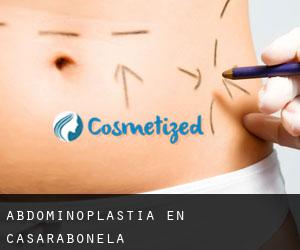 Abdominoplastia en Casarabonela