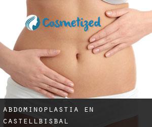 Abdominoplastia en Castellbisbal