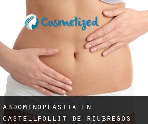 Abdominoplastia en Castellfollit de Riubregós