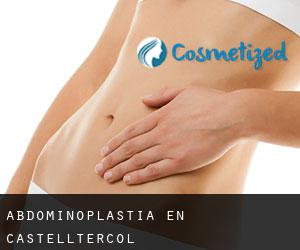Abdominoplastia en Castellterçol