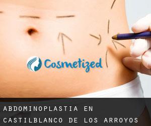 Abdominoplastia en Castilblanco de los Arroyos