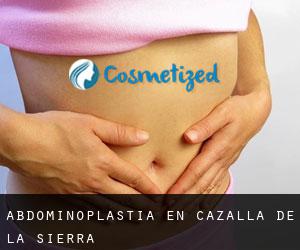Abdominoplastia en Cazalla de la Sierra