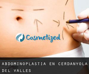 Abdominoplastia en Cerdanyola del Vallès