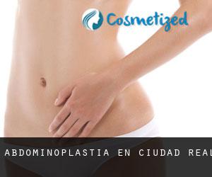 Abdominoplastia en Ciudad Real
